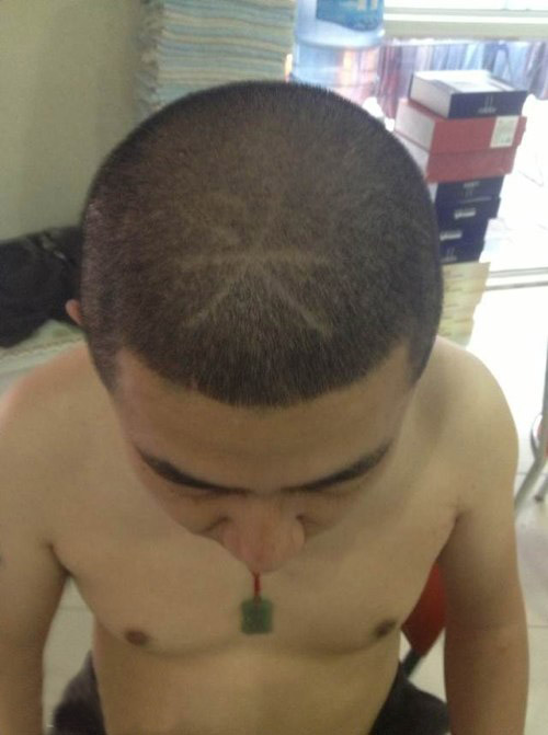 好大的一个头。