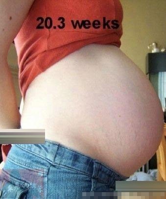 怀孕20周