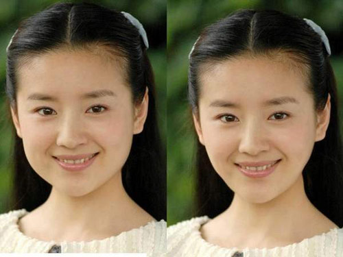 董洁变成锥子脸了，元芳，你怎么看？