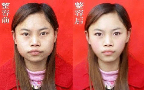 凤姐整容后照片
